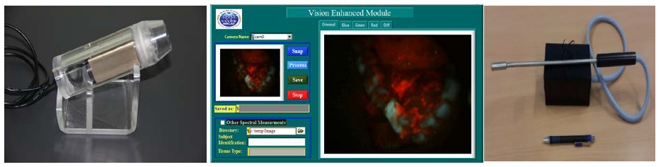 OncoVision -Vision Enhancement Module