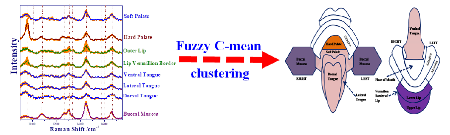 Clustering of Raman spectra based on the anatomical locations of the target tissue sites of the oral cavity. Ref: Biomedical Spectroscopy and Imaging, 2(13), 199-217, 2013.